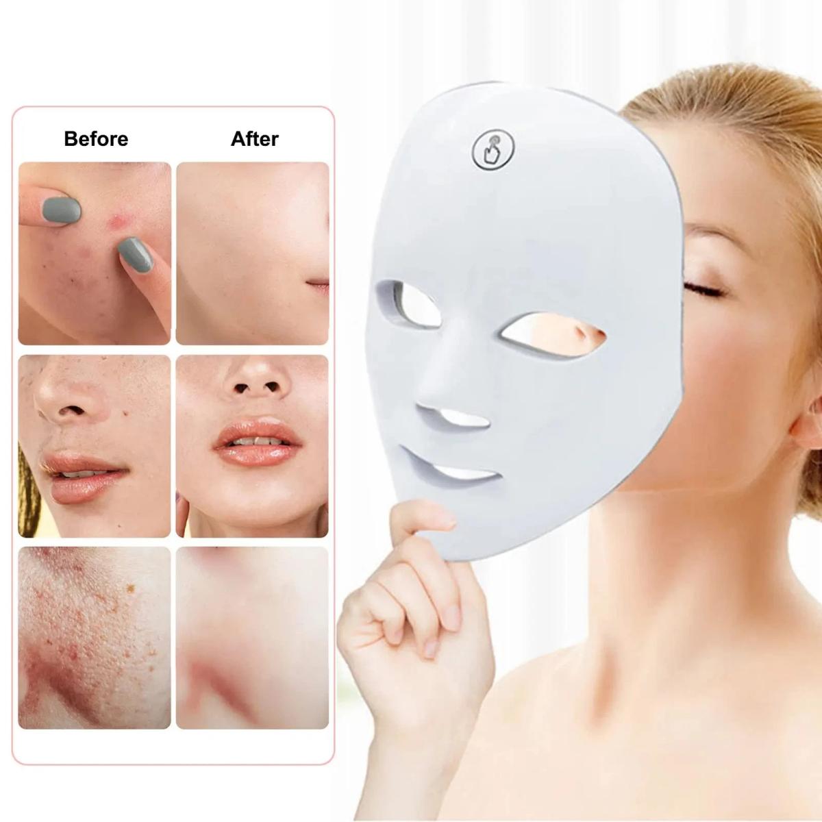 Voor en na resultaat LED gezichtsmasker