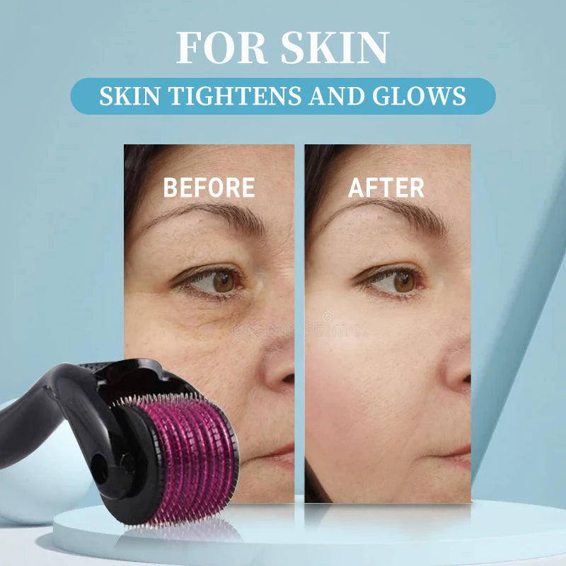 Derma roller 0.25mm